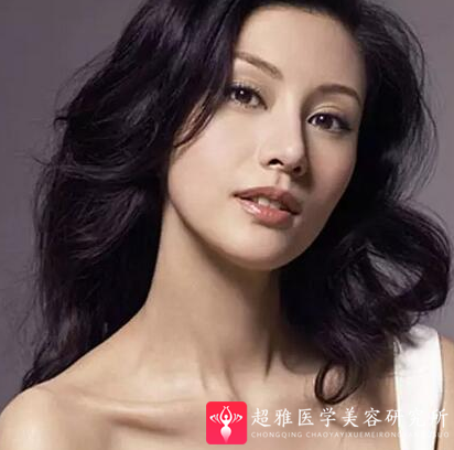 隆鼻手术