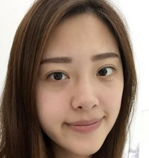 面部提升术