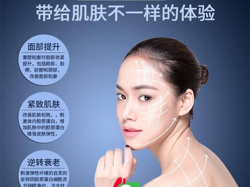 面部提升术