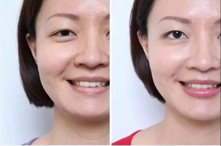 超级微拉美