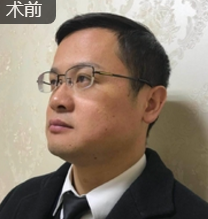 面部提升术