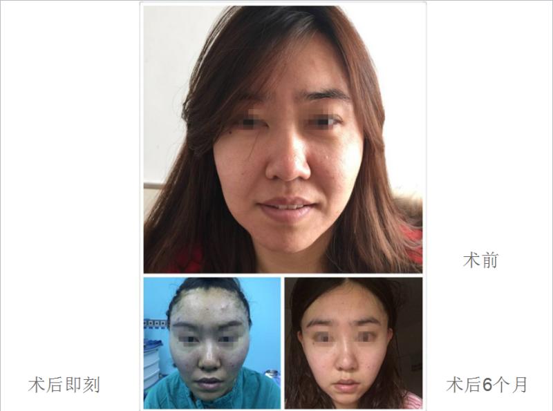 超级微拉美