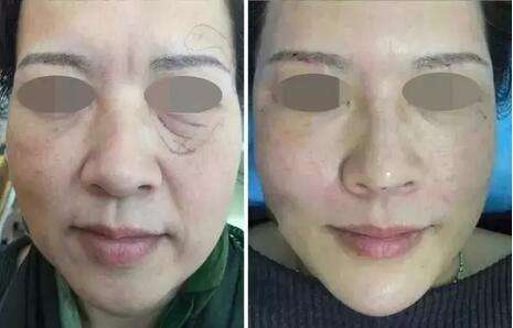 超级微拉美