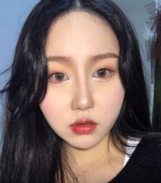 超声波瘦脸