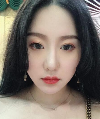 超声波瘦脸