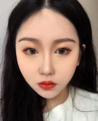 超声波瘦脸