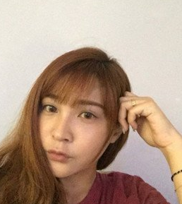 面部提升术