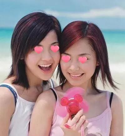 自体脂肪填充术