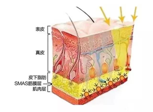 自体脂肪填充术