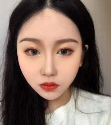 超声波瘦脸