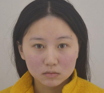 超声波瘦脸