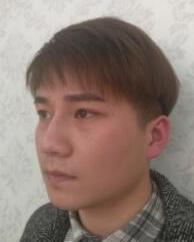 超声波瘦脸