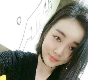 自体脂肪填充术