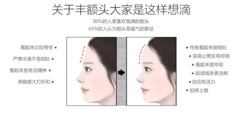自体脂肪填充术