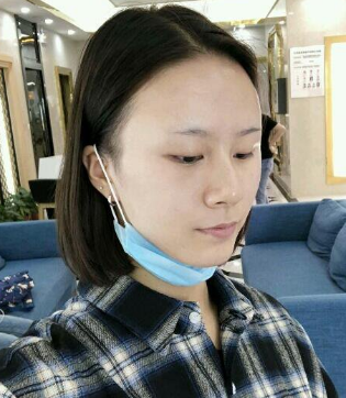 自体脂肪填充术