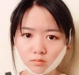 超声波瘦脸