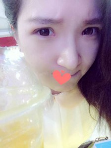 超声波去眼袋