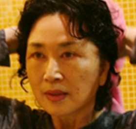 面部提升术