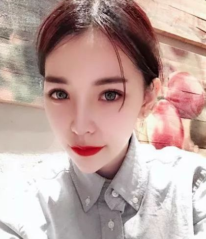 隆鼻手术
