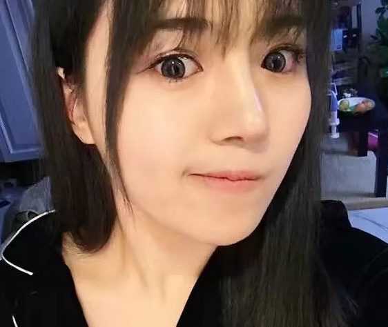 隆鼻手术