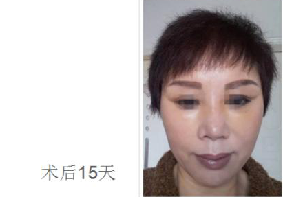 超级微拉美