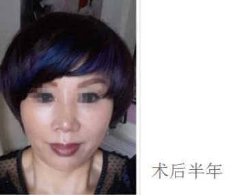 超级微拉美
