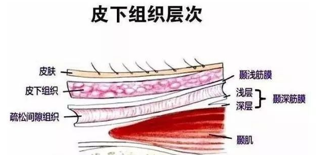 自体脂肪填充术