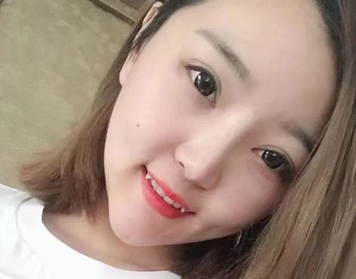 超声波瘦脸
