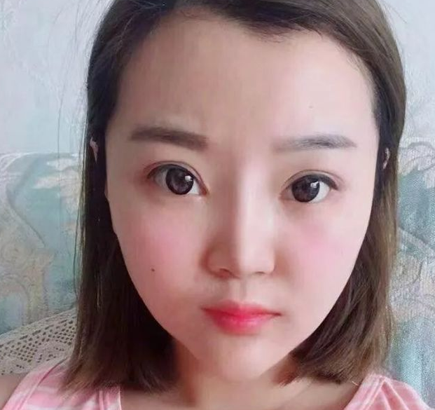 超声波瘦脸