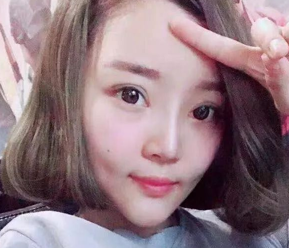 超声波瘦脸
