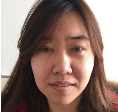 超级微拉美