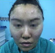 超级微拉美