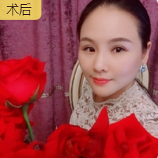 超级微拉美