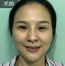 超级微拉美