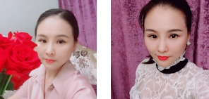 超级微拉美
