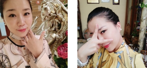 面部提升术