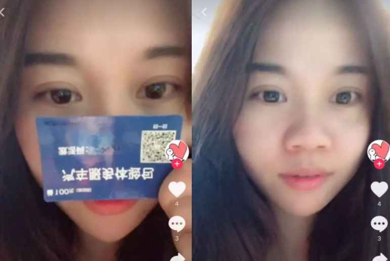 隆鼻手术