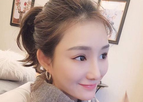 隆鼻手术
