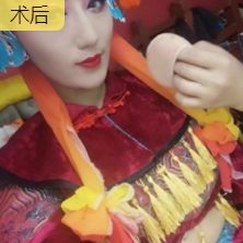 隆鼻手术