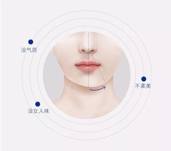 超声波瘦脸