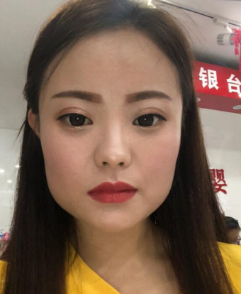 超声波瘦脸