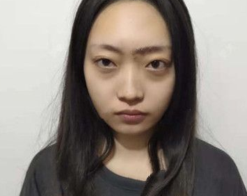 超声波瘦脸
