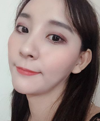 超声波瘦脸