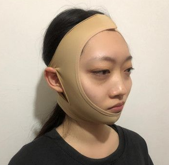 超声波瘦脸