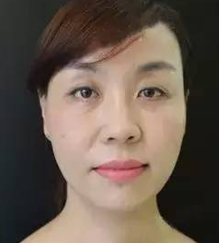 超级微拉美