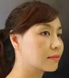 超级微拉美