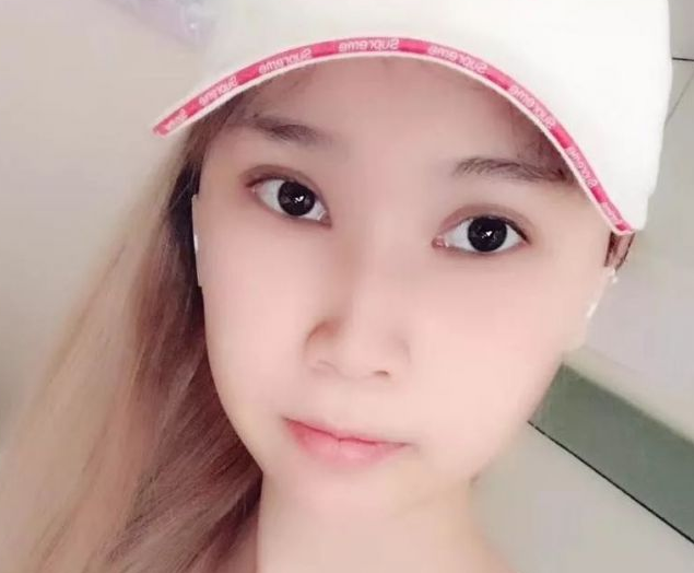 超声波瘦脸