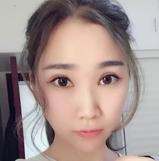 超声波瘦脸