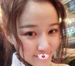 超声波瘦脸