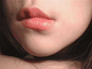 玻尿酸丰唇